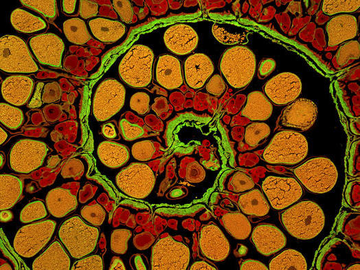 Anglerfish Ovary